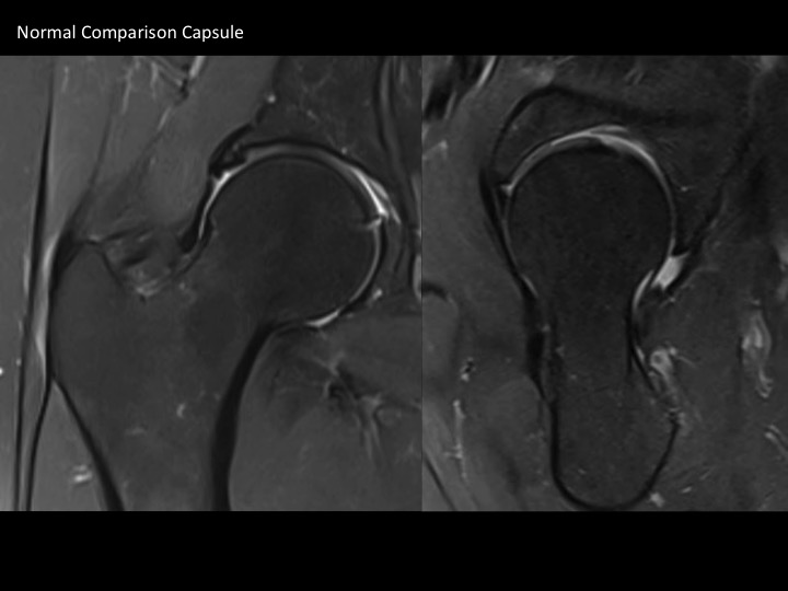 Figure 5 for case joint capsule ( RID6072 )